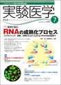 解明が進む RNAの成熟化プロセス
