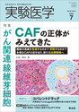 がん関連線維芽細胞CAFの正体がみえてきた