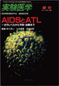 AIDSとATL