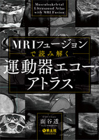 MRIフュージョンで読み解く　運動器エコーアトラス