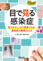 目で見る感染症〜見ためでここまで診断できる！感染症の画像アトラス