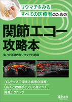 リウマチをみるすべての医療者のための関節エコー攻略本