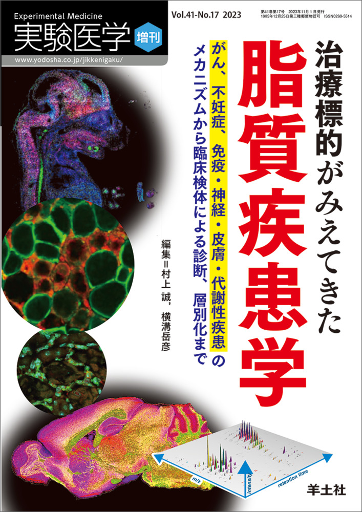 実験医学増刊：治療標的がみえてきた脂質疾患学〜がん、不妊症、免疫