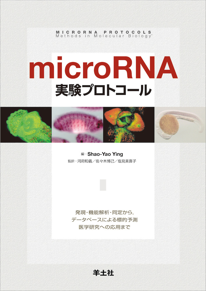 microRNA実験プロトコール〜発現・機能解析・同定から，データベースによる標的予測，医学研究への応用まで