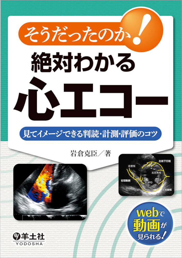 そうだったのか 絶対わかる心エコー 見てイメージできる判読 計測 評価のコツ 羊土社