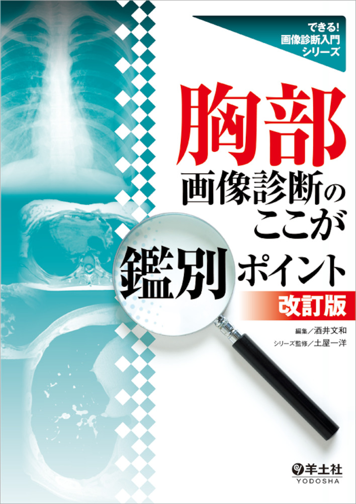 症状から引く胸部画像診断―流れがわかる検査・診断のコツ 中島康雄; 松岡　伸