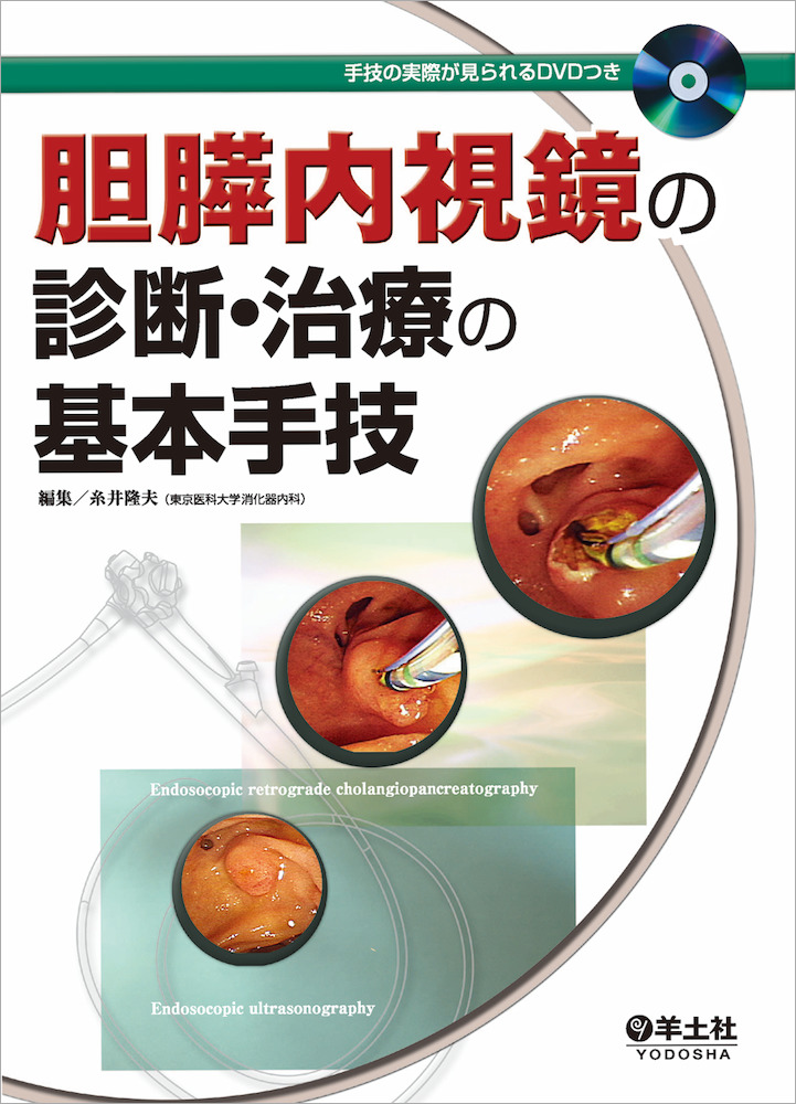 【裁断済】胆膵内視鏡 診断・治療の基本手技 第4版