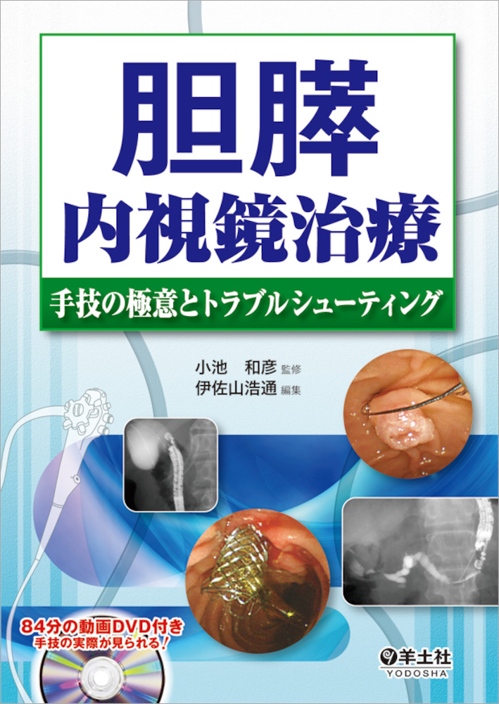 胆膵内視鏡治療 手技の極意とトラブルシューティング - 羊土社