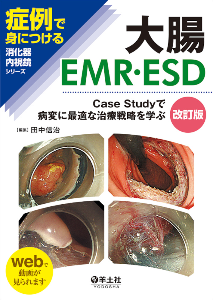 症例で身につける消化器内視鏡シリーズ：大腸EMR・ESD 改訂版〜Case Studyで病変に最適な治療戦略を学ぶ