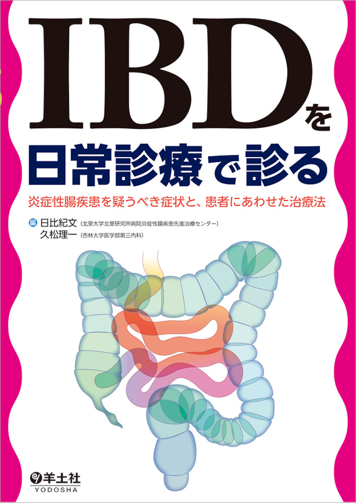 IBDを日常診療で診る〜炎症性腸疾患を疑うべき症状と、患者にあわせた治療法