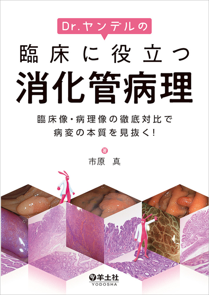 Dr.ヤンデルの臨床に役立つ消化管病理〜臨床像・病理像の徹底対比で病変の本質を見抜く！