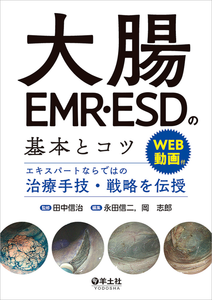 大腸emr Esdの基本とコツ エキスパートならではの治療手技 戦略を伝授 羊土社