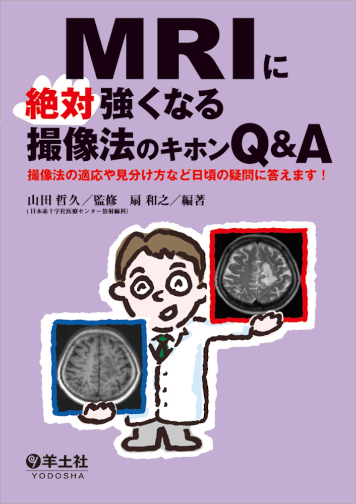 Mri 使い分け ct