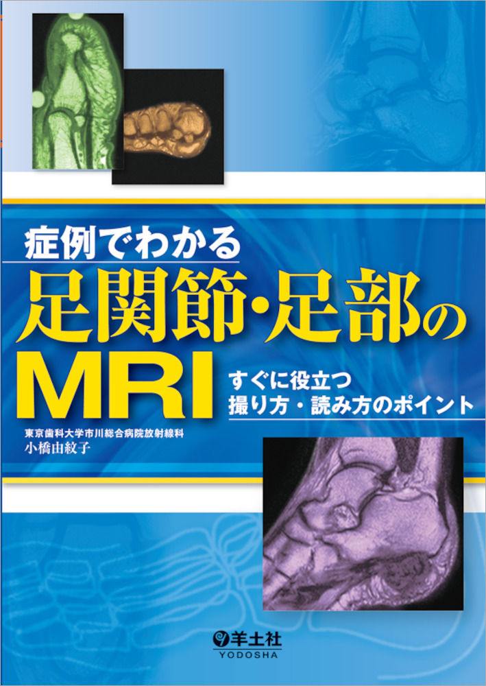 症例でわかる足関節・足部のMRI?すぐに役立つ撮り方・読み方のポイント