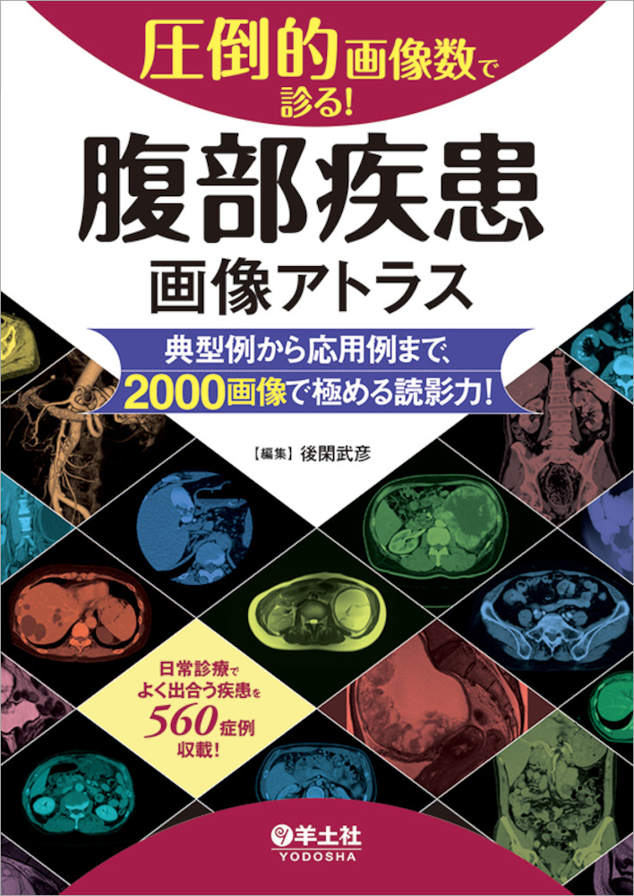 圧倒的画像数で診る！ 腹部疾患画像アトラス〜典型例から応用例まで