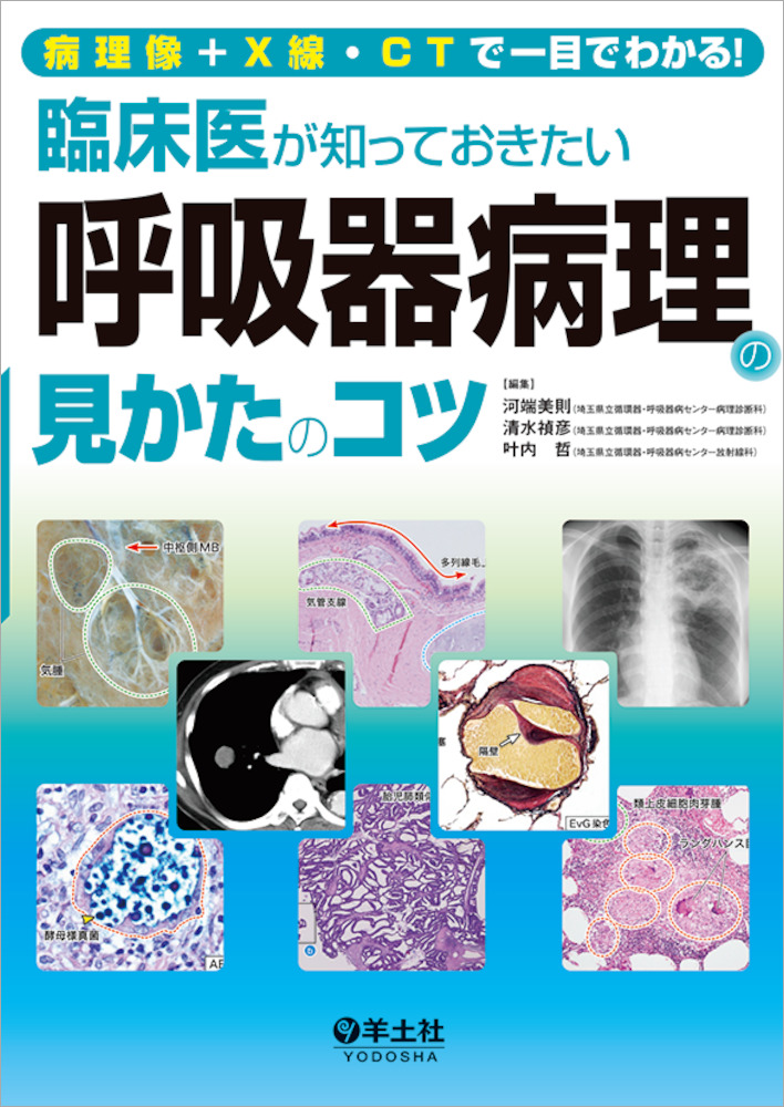 病理像＋X線・CTで一目でわかる！ 臨床医が知っておきたい呼吸器病理の 