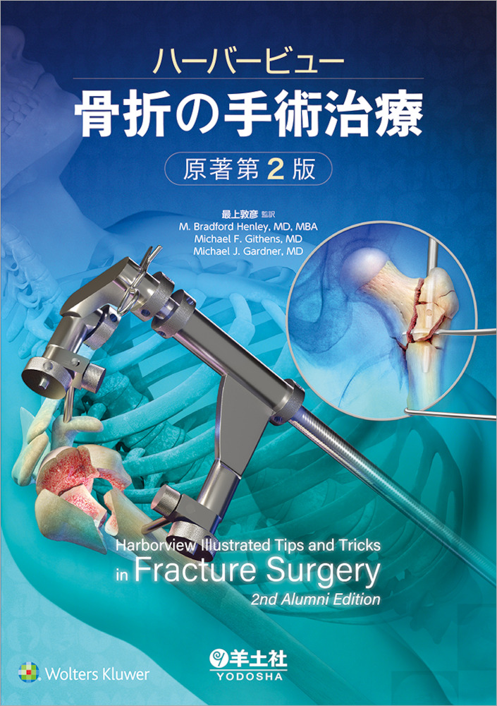 ハーバービュー　骨折の手術治療　原著第2版