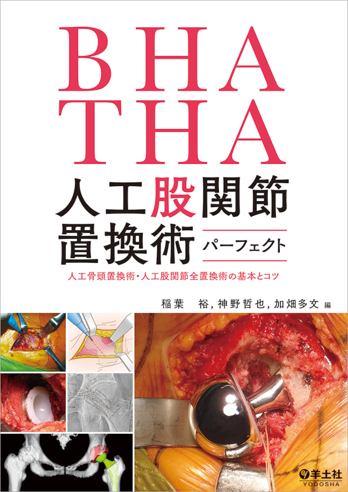 Bha Tha 人工股関節置換術パーフェクト 人工骨頭置換術 人工股関節全置換術の基本とコツ 羊土社