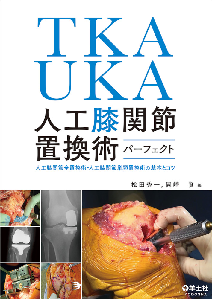 TKA・UKA　人工膝関節置換術パーフェクト〜人工膝関節全置換術・人工膝関節単顆置換術の基本とコツ