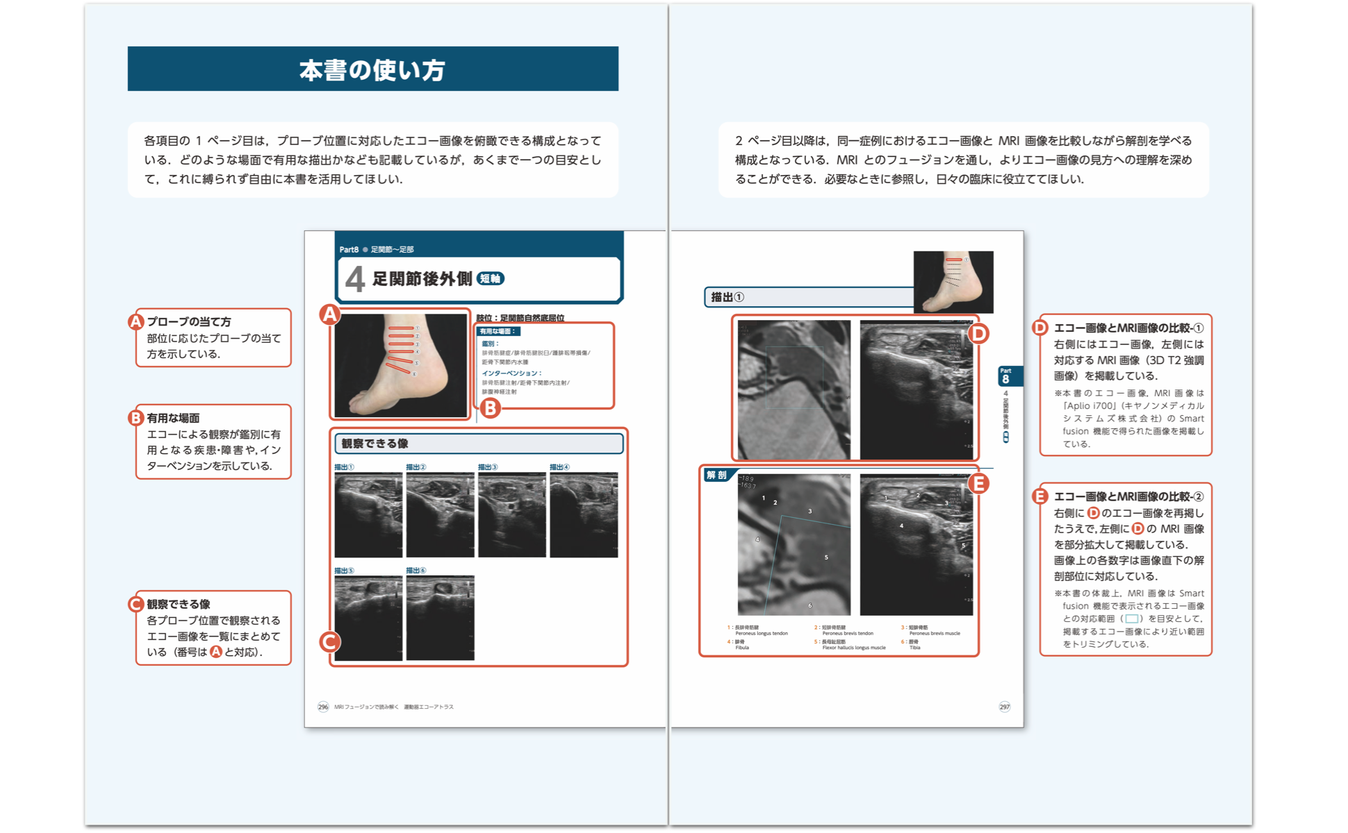 MRIフュージョンで読み解く　運動器エコーアトラス