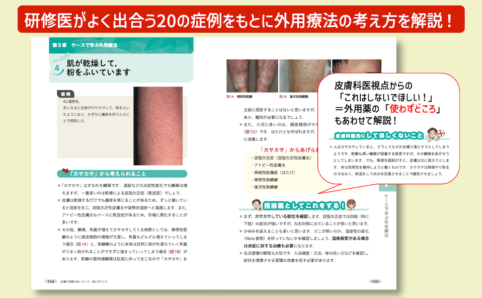 皮膚外用薬の使いどころ・使わずどころ
