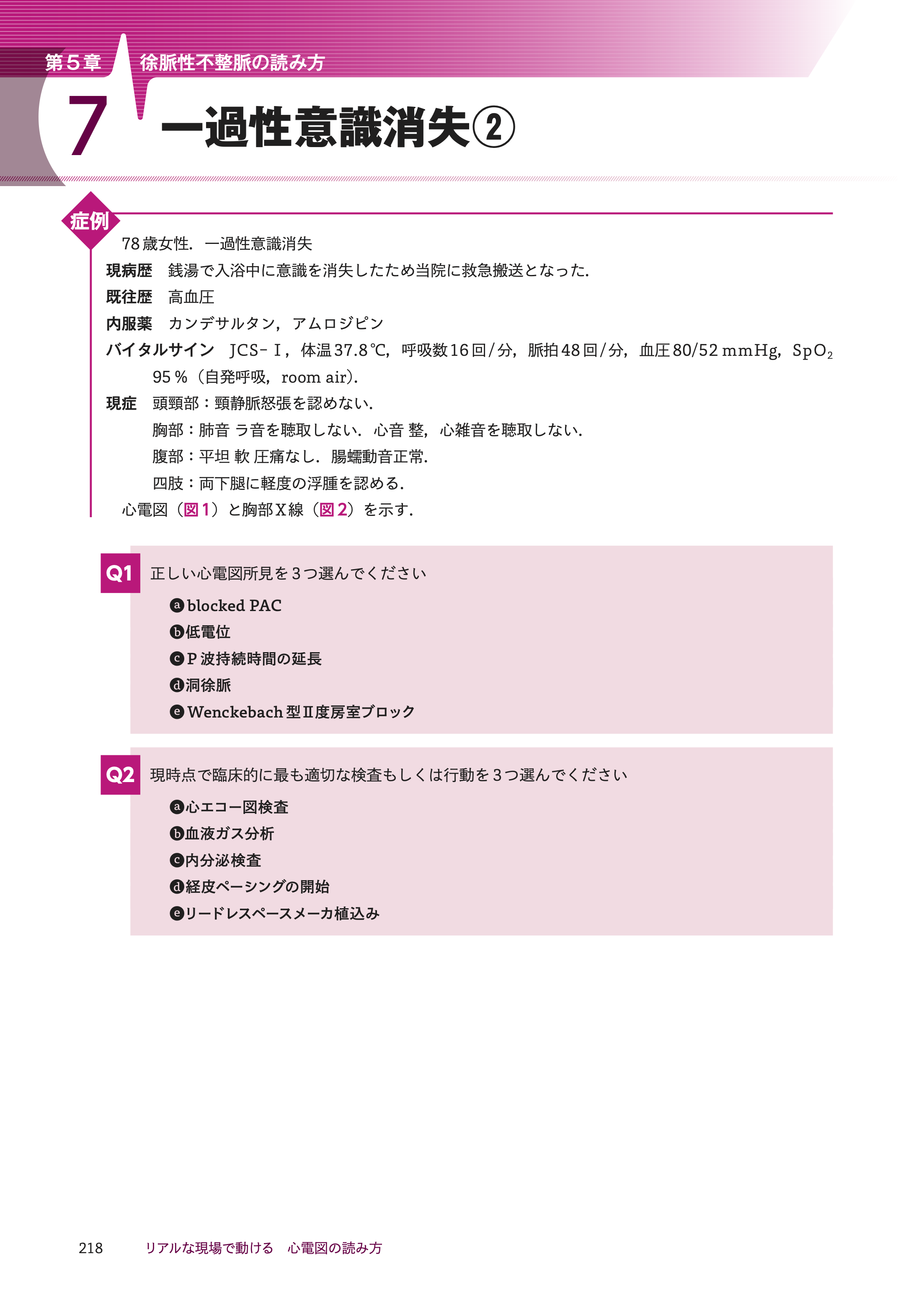 リアルな現場で動ける　心電図の読み方