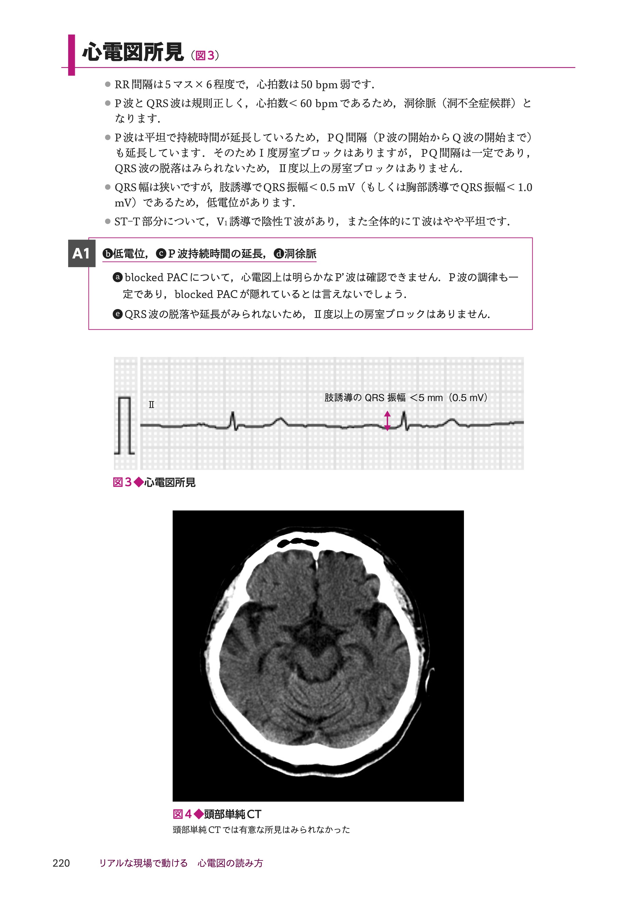 リアルな現場で動ける　心電図の読み方