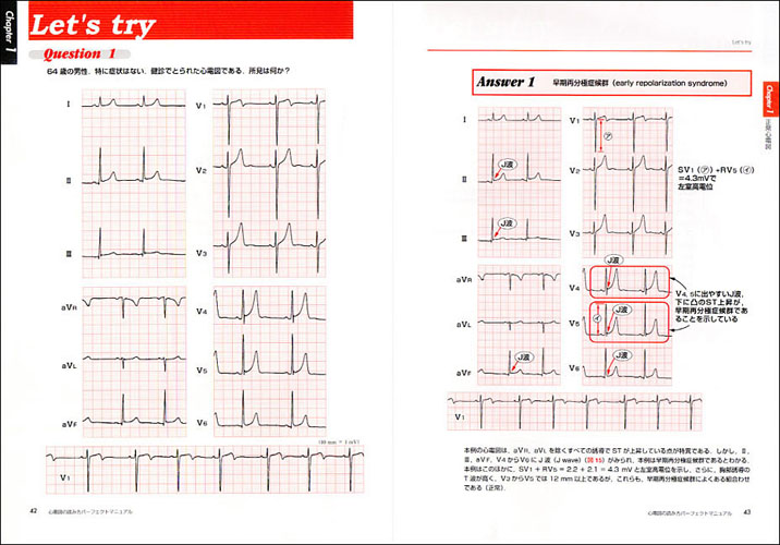 心電図の読み方パーフェクトマニュアル 理論と波形パターンで徹底トレーニング 羊土社