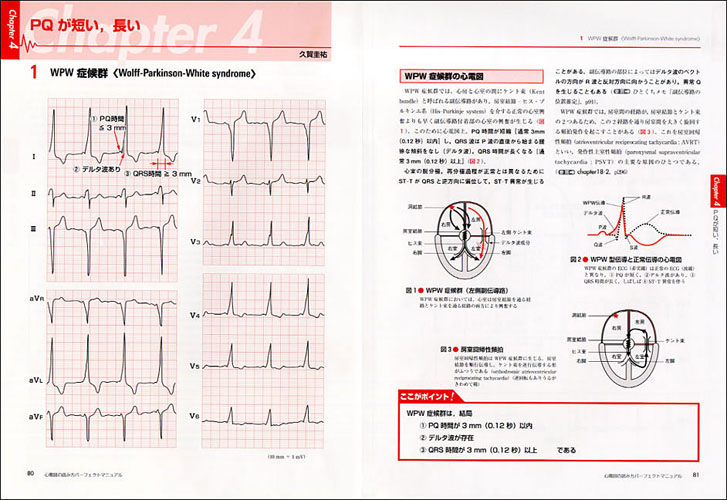 心電図の読み方パーフェクトマニュアル 理論と波形パターンで徹底