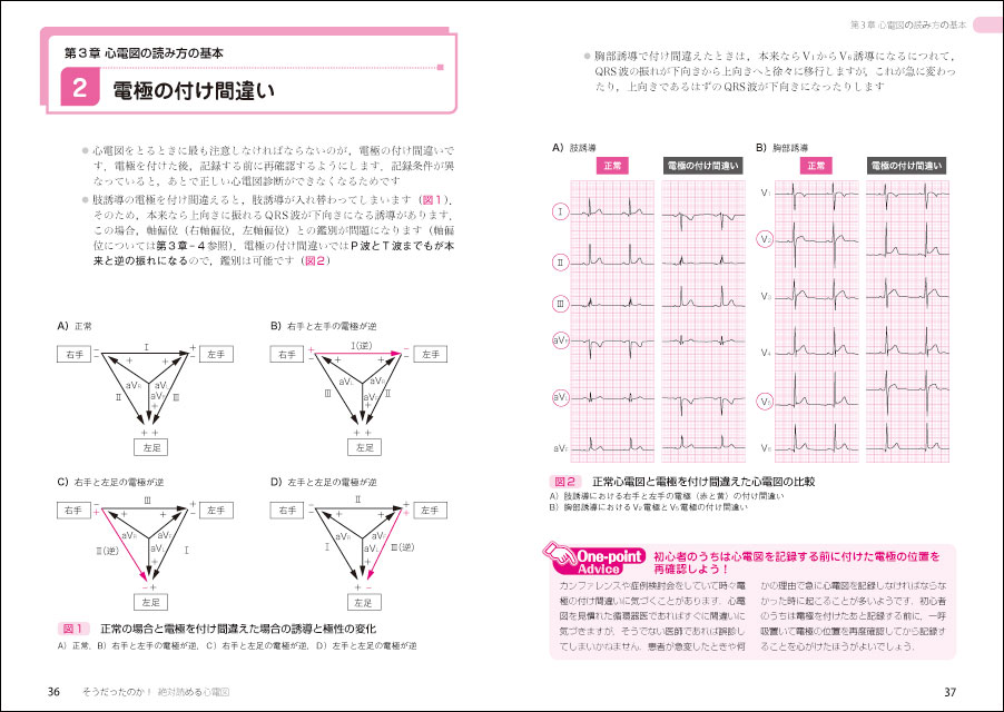 そうだったのか！絶対読める心電図〜目でみてわかる緊急度と判読の