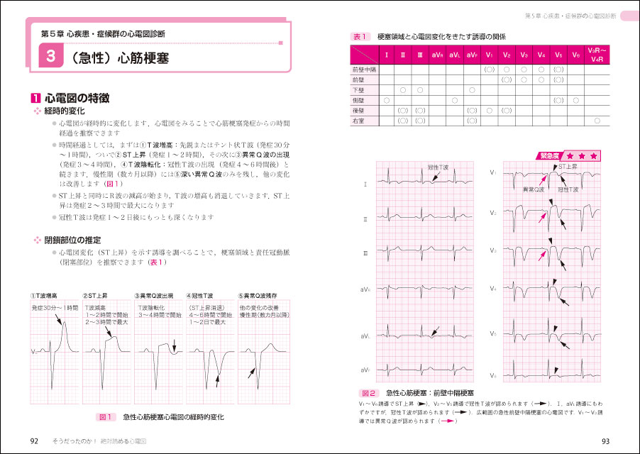 そうだったのか！絶対読める心電図〜目でみてわかる緊急度と判読の