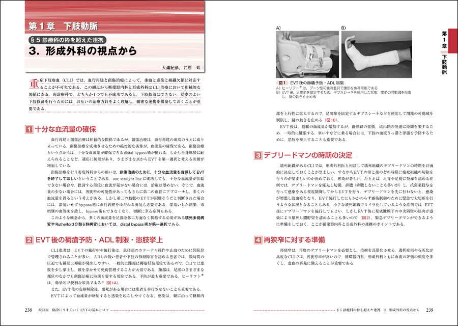 Rutherford´s VASCULAR SURGERY格段に上手くいくEVT 直販ショッピング