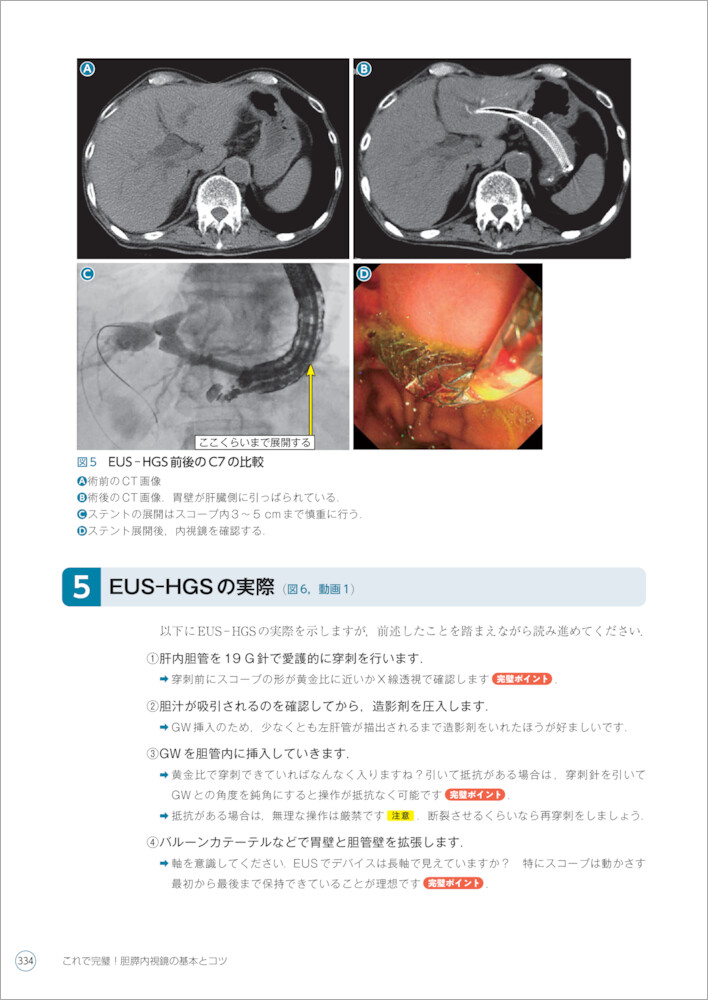 消化器内視鏡第29巻5号 ERCPのエキスパートを目指して 消化器内視鏡編集委員会