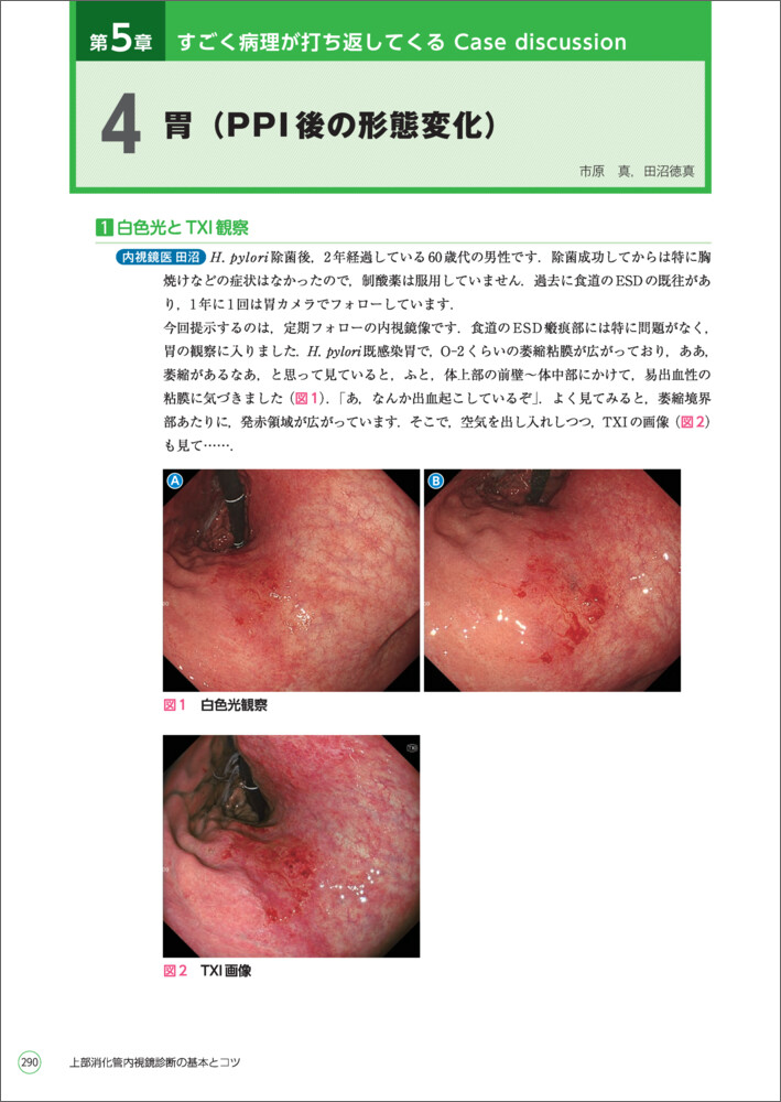 上部消化管内視鏡診断の基本とコツ〜内視鏡検査の実際どうする？を