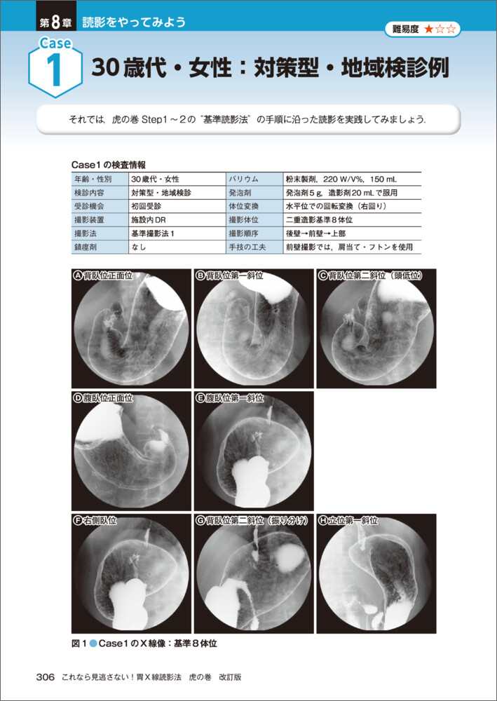 胃X線診断の考え方と進め方　胃X線読影の基本と実際 胃X線診断の考え方と進め方 | 裕司, 吉田, 平三郎, 市川 |本