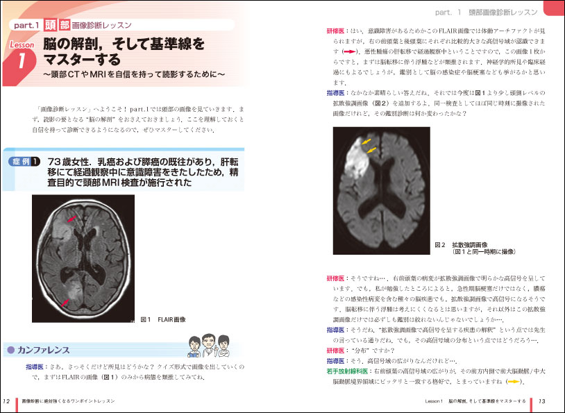 画像 診断 に 絶対 強く なる ワン ポイント レッスン