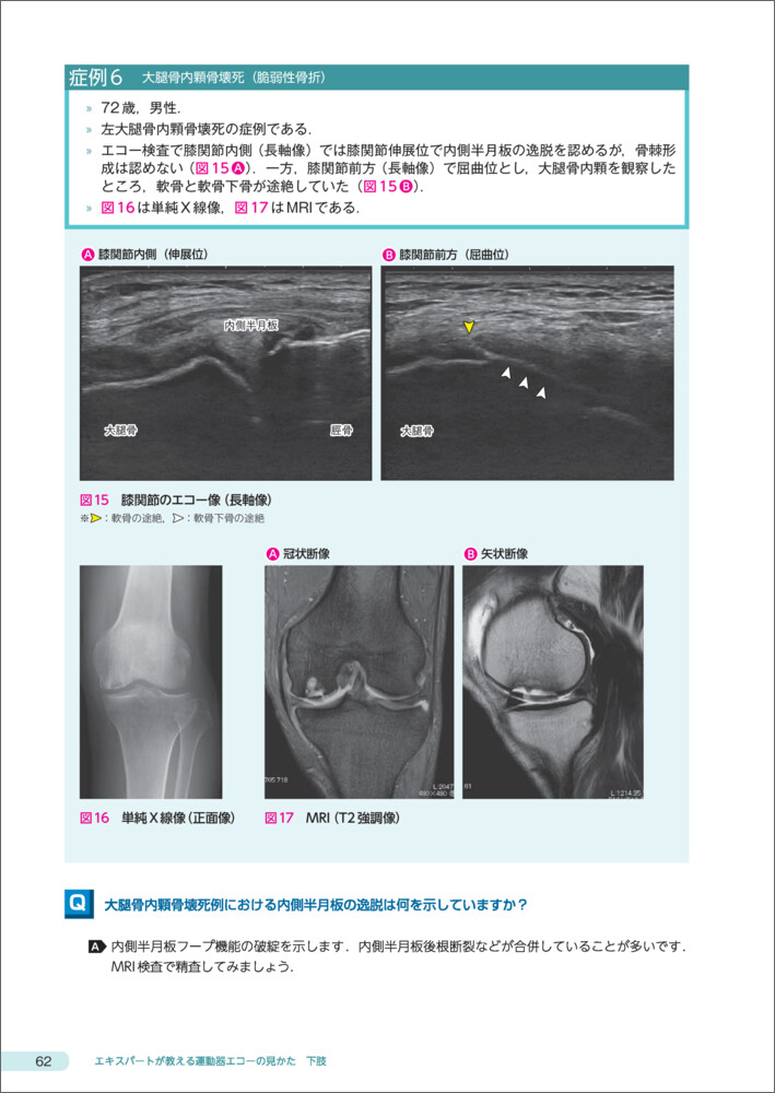 エキスパートが教える運動器エコーの見かた 下肢〜診療の鍵となる着眼 エキスパートが教える運動器エコーの見かた 下肢〜診療の鍵となる着眼