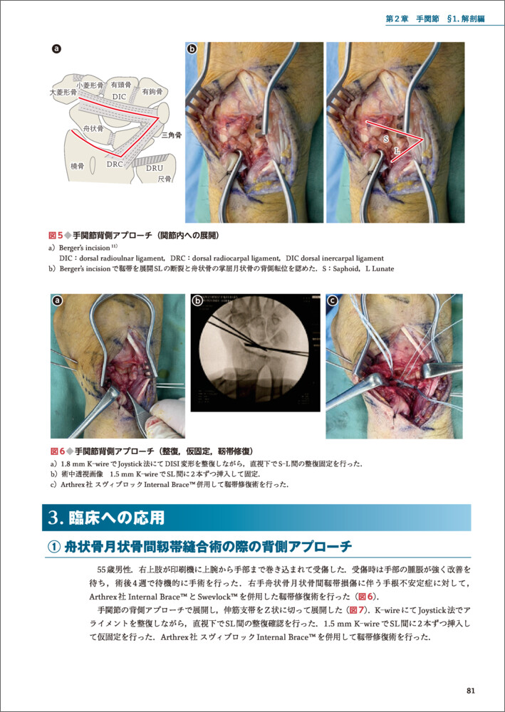 手・前腕・肘の外傷 解剖と手術手技 - 羊土社