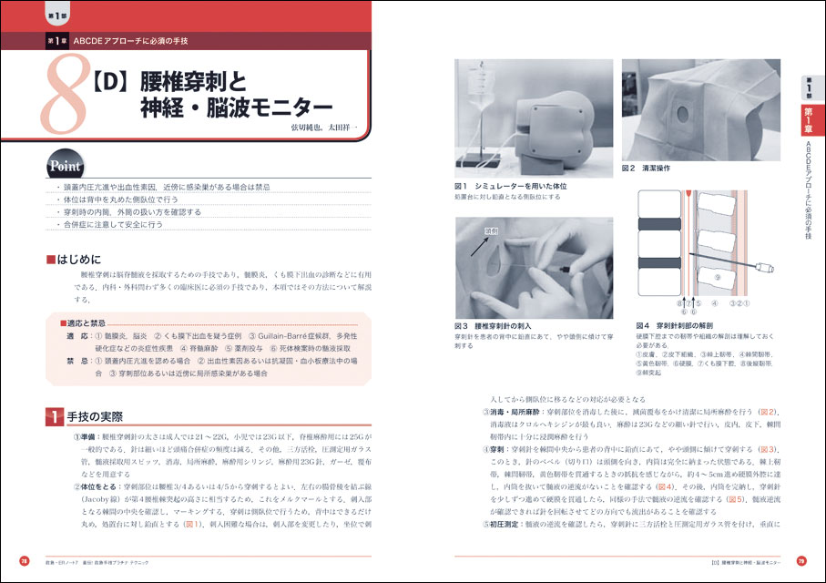 救急 Erノート レジデントノート別冊 直伝 救急手技プラチナ テクニック 手技はもちろん 合併症や施行後に考えることなど 次の一手まで見据えた王道アプローチを伝授 羊土社