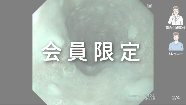 Case 003 食道 上部食道 平坦陥凹性病変 サムネール