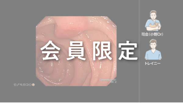 Case 004 十二指腸 下行部 平坦隆起性病変 サムネール