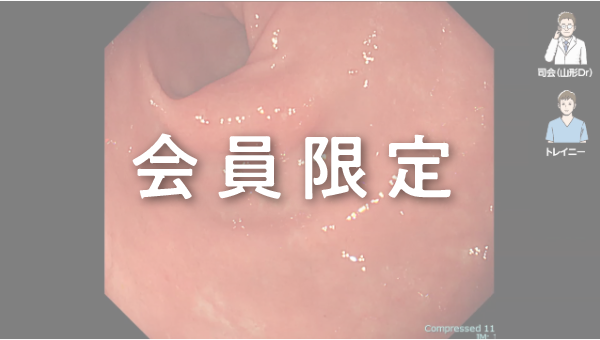 Case 006 胃 胃角後壁 平坦隆起性病変 サムネール