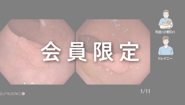Case 007 大腸 直腸 平坦隆起性病変 サムネール