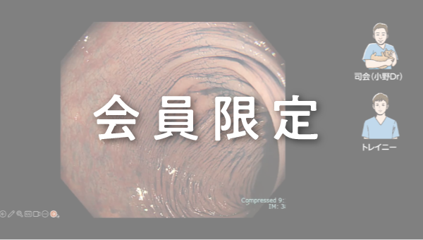 Case 008 大腸 S状結腸 平坦隆起性病変 サムネール