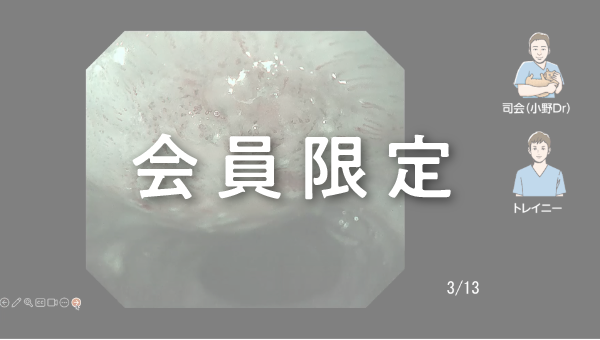 Case 009 食道 上部食道 平坦陥凹性病変 サムネール