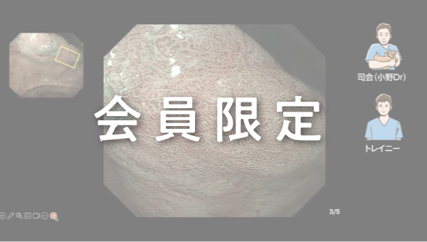 Case 010 胃 胃角部 平坦陥凹性病変 サムネール