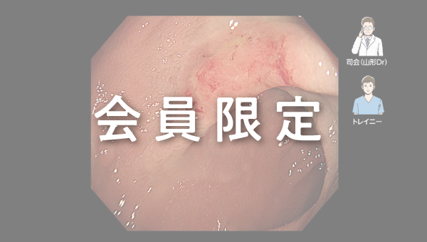 Case 011 大腸 直腸 陥凹性病変 サムネール