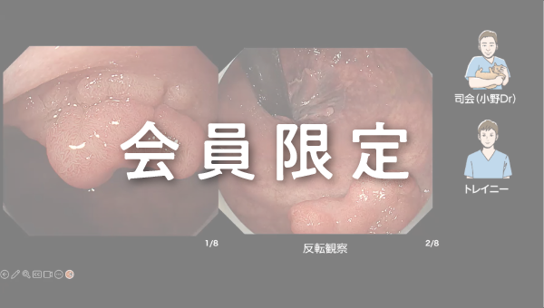 Case 012 大腸 直腸 隆起性病変 サムネール