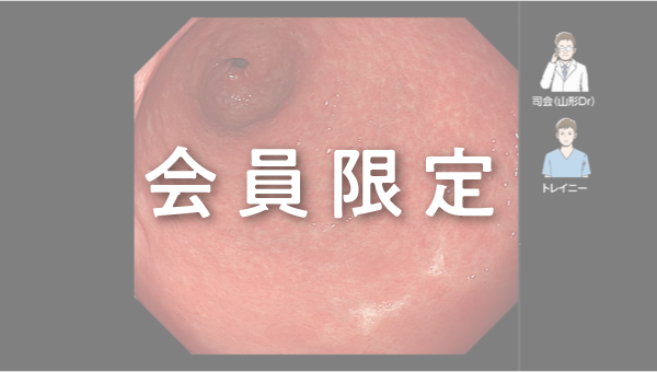Case 013 胃 体上部 隆起性病変 サムネール