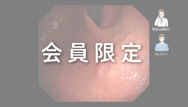 Case 013 胃 体上部 隆起性病変 サムネール